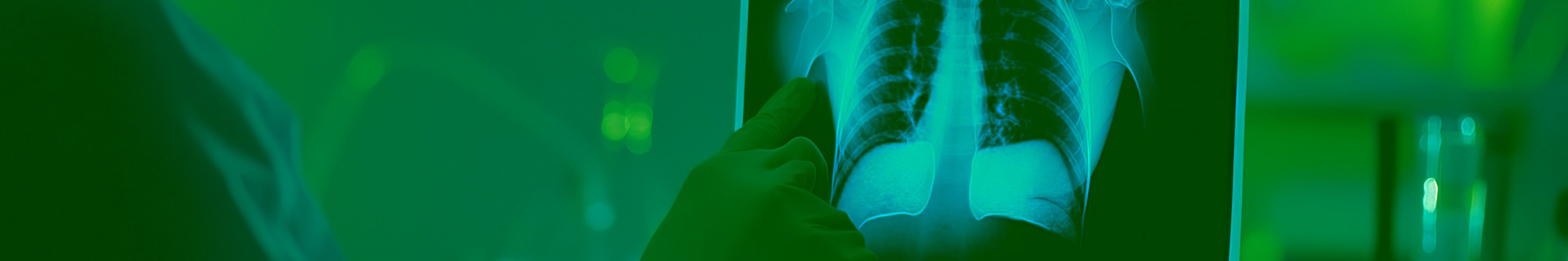 レントゲンフィルム買取