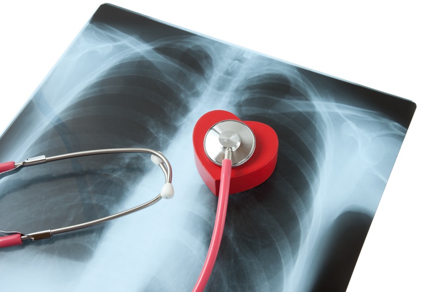 レントゲンフィルム